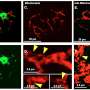 A closer look at hard-to-see cells could answer new questions about nerve damage and recovery