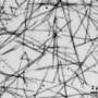 Assembly pathway reveals how bacteria build protein coils that extend in acid
