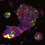 Chain reaction that begins when tumor suppression gene is switched off offers clues to how cancer develops