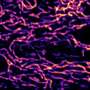 Longer lives despite mitochondrial defects? Worms rely on calcium-triggered 'cages'