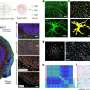 Nanoneedle arrays map RNA in fresh tissue without sequencing or amplification