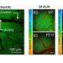 Optical imaging links altered metabolism and oxygen use in Alzheimer's disease
