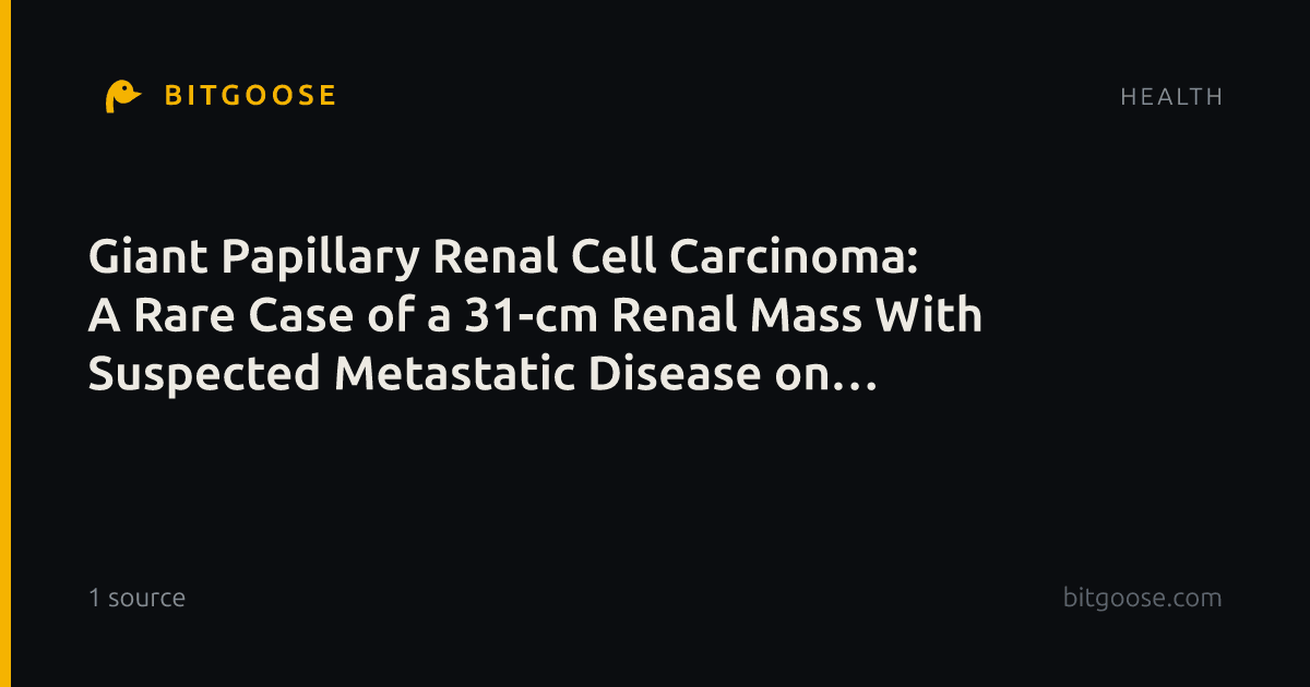 Giant Papillary Renal Cell Carcinoma: A Rare Case of a 31-cm Renal Mass With Suspected Metastatic Disease on Imaging